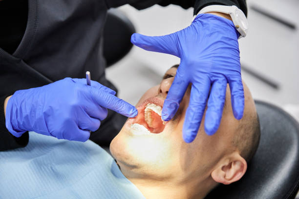 Best Emergency Treatment for Dental Infections or Abscesses in Canonsburg, PA
