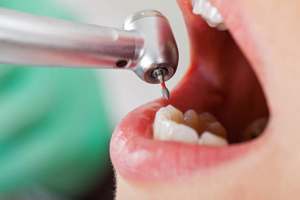 Best Pediatric Emergency Dentist in Canonsburg, PA
